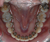 orthodontiste courbevoie marceau